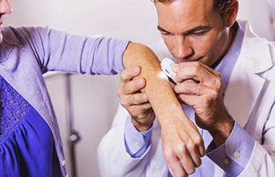 Dermatologist examining age spot